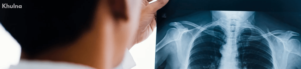 খুলনার সেরা বক্ষব্যাধি বিশেষজ্ঞ ডাক্তার _20250520_230409_0000-min খুলনার সেরা বক্ষব্যাধি বিশেষজ্ঞ ডাক্তার