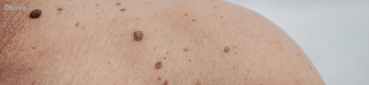 ঢাকার সেরা চর্ম ও যৌন রোগ বিশেষজ্ঞ ডাক্তার | Dermatology and Venereology Specialist in Dhaka ঢাকার সেরা চর্ম ও যৌন রোগ বিশেষজ্ঞ ডাক্তার | Dermatology and Venereology Specialist in Dhaka